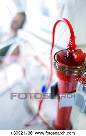 Stock Photograph - Kidney dialysis. Fotosearch
