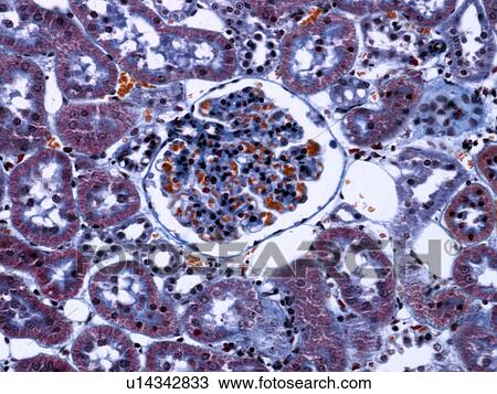 Stock Image - Kidney glomerulus, light micrograph. Fotosearch
