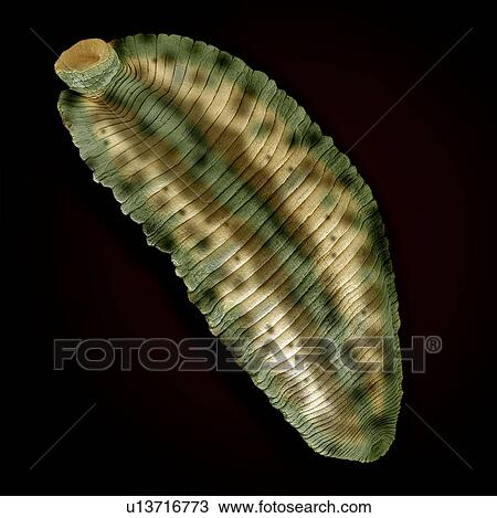 Leech, SEM View Large Photo Image Stock Image - Leech, SEM. Fotosearch