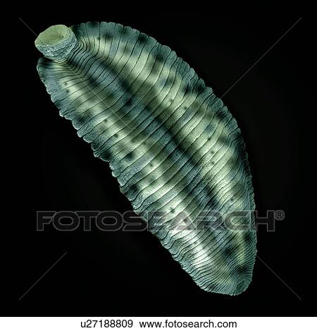 Leech, SEM View Large Photo Image Stock Photo - Leech, SEM. Fotosearch