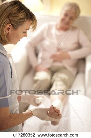 Leg ulcer treatment View Large Photo Image Stock Image - Leg ulcer treatment. Fotosearch