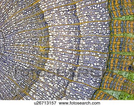 Stock Photo - Lime tree stem, light micrograph. Fotosearch