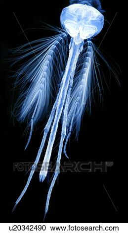 Stock Image - Male mosquito head, light micrograph. Fotosearch