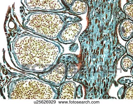 Stock Photo - Male pine cone, light micrograph. Fotosearch