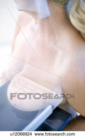 Mammography View Large Photo Image Picture - Mammography. Fotosearch