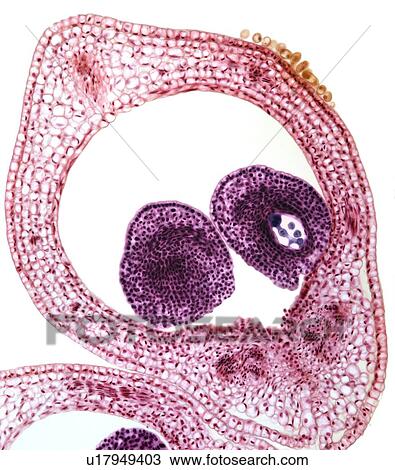 Stock Image - Marsh marigold carpel, light micrograph. Fotosearch