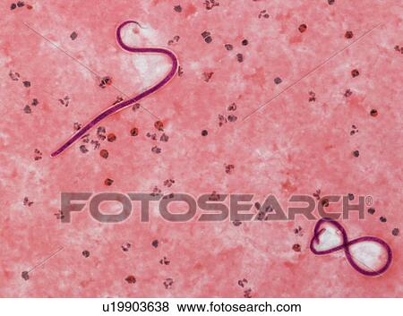 Stock Photo - Microfilaria worms, light micrograph. Fotosearch