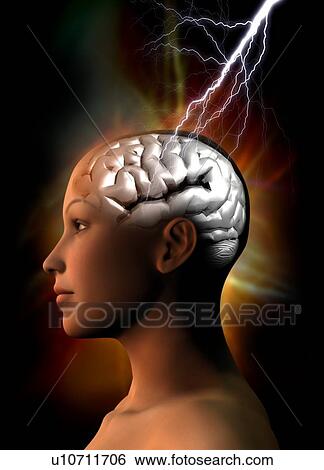 Migraine, conceptual artwork View Large Photo Image Stock Photograph - Migraine, conceptual artwork. Fotosearch