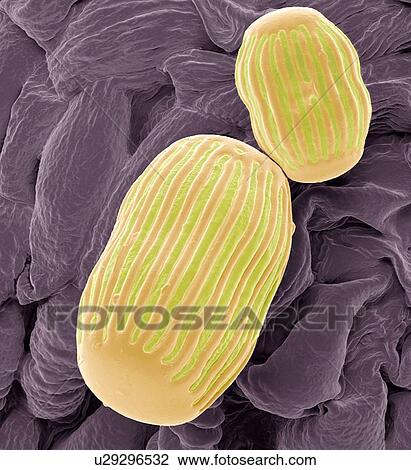 Milkwort pollen, SEM View Large Photo Image Stock Image - Milkwort pollen, SEM. Fotosearch