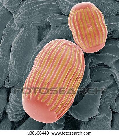 Milkwort pollen, SEM View Large Photo Image Stock Image - Milkwort pollen, SEM. Fotosearch