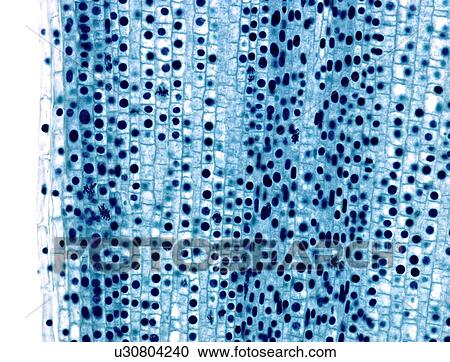 Mitosis, light micrograph View Large Photo Image Stock Image - Mitosis, light micrograph. Fotosearch