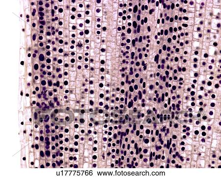 Mitosis, light micrograph View Large Photo Image Stock Photograph - Mitosis, light micrograph. Fotosearch