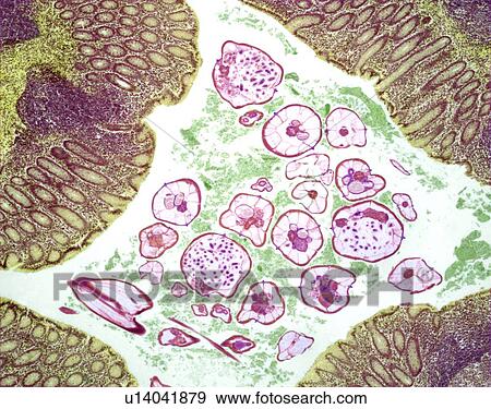 Nematode infection, light micrograph View Large Photo Image Stock Photo - Nematode infection, light micrograph. Fotosearch