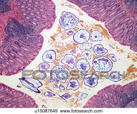 Nematode infection, light micrograph View Large Photo Image Stock Photo - Nematode infection, light micrograph. Fotosearch