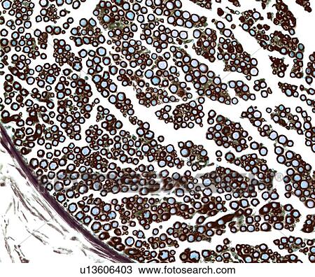 Stock Image - Nerve fibres, light micrograph. Fotosearch