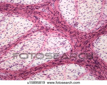 Stock Photo - Omentum, light micrograph. Fotosearch