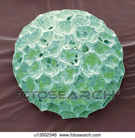 Phlox pollen, SEM View Large Photo Image Stock Photograph - Phlox pollen, SEM. Fotosearch