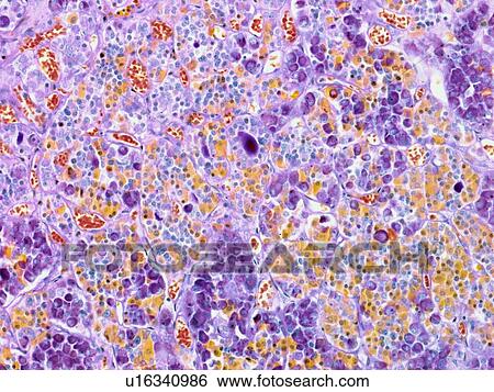 Stock Photograph - Pituitary gland, light micrograph. Fotosearch