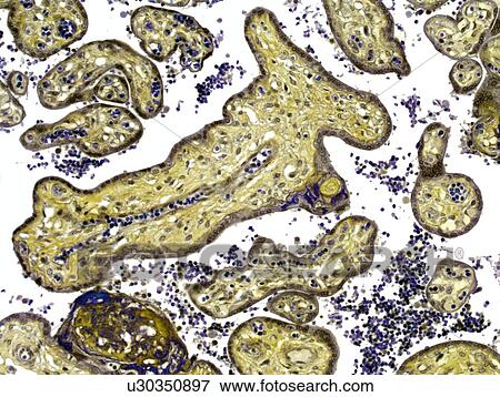Placenta, light micrograph View Large Photo Image Stock Photo - Placenta, light micrograph. Fotosearch