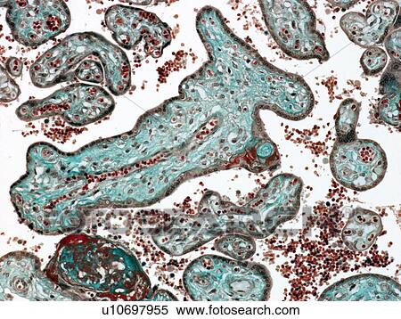 Placenta, light micrograph View Large Photo Image Stock Photography - Placenta, light micrograph. Fotosearch