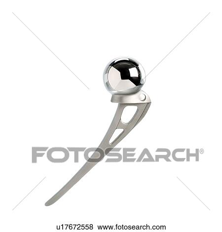 Stock Photo - Prosthetic ball joint. Fotosearch