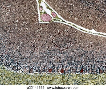 Stock Photograph - Purkinje cells, light micrograph. Fotosearch