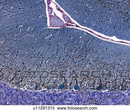 Stock Photography - Purkinje cells, light micrograph. Fotosearch