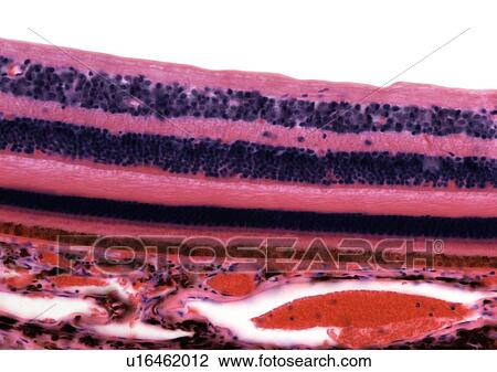 Retina, light micrograph View Large Photo Image Stock Image - Retina, light micrograph. Fotosearch