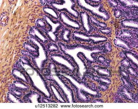 Seminal vesicle, light micrograph View Large Photo Image Stock Image - Seminal vesicle, light micrograph. Fotosearch