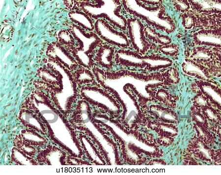 Seminal vesicle, light micrograph View Large Photo Image Stock Image - Seminal vesicle, light micrograph. Fotosearch