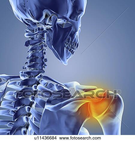 Shoulder pain, computer artwork View Large Photo Image Picture - Shoulder pain, computer artwork. Fotosearch