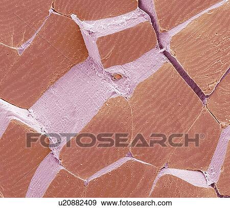 Skeletal muscle fibres, SEM View Large Photo Image Stock Photo - Skeletal muscle fibres, SEM. Fotosearch