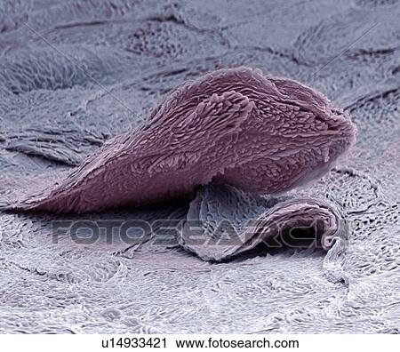 Stock Image - Skin cell, SEM. Fotosearch
