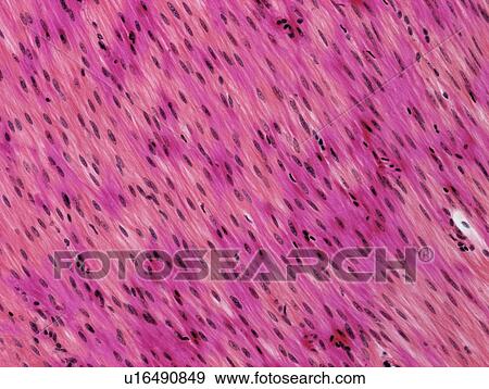 Stock Photo - Smooth muscle, light micrograph. Fotosearch