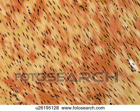 Stock Photo - Smooth muscle, light micrograph. Fotosearch