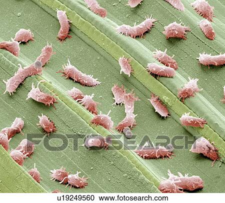 Stagnant water bacteria, SEM View Large Photo Image Stock Image - Stagnant water bacteria, SEM. Fotosearch