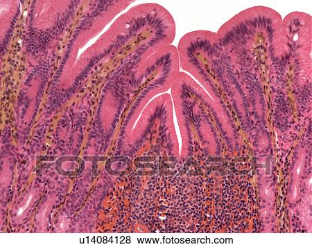 Stock Photo - Stomach lining, light micrograph. Fotosearch