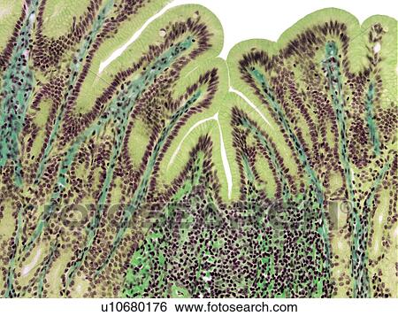 Stomach lining, light micrograph View Large Photo Image Stock Photograph - Stomach lining, light micrograph. Fotosearch
