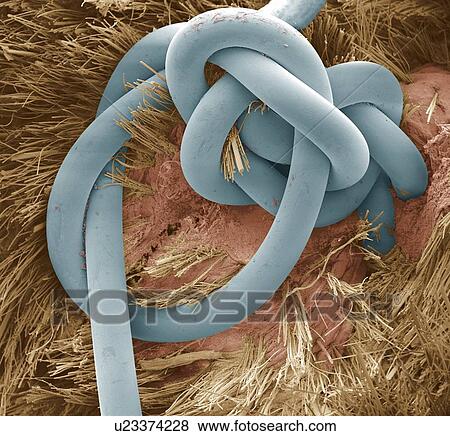 Stock Photo - Sutured wound, SEM. Fotosearch