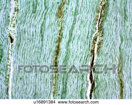 Tendon, light micrograph View Large Photo Image Picture - Tendon, light micrograph. Fotosearch