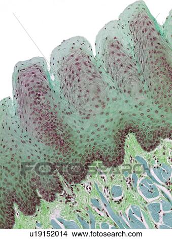Tongue, light micrograph View Large Photo Image Picture - Tongue, light micrograph. Fotosearch