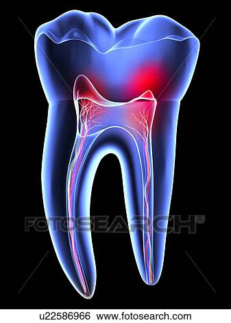 Tooth pain, toothache View Large Photo Image Stock Photograph - Tooth pain, toothache. Fotosearch