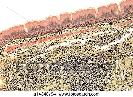 Trachea, light micrograph View Large Photo Image Picture - Trachea, light micrograph. Fotosearch