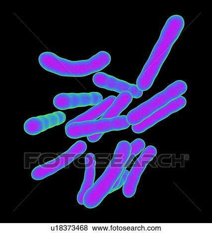 Tuberculosis bacteria, artwork View Large Photo Image Stock Photo - Tuberculosis bacteria, artwork. Fotosearch