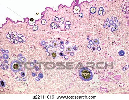 Stock Photo - Upper lip skin, light micrograph. Fotosearch