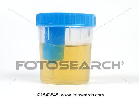 Urine sample View Large Photo Image Stock Photography - Urine sample. Fotosearch