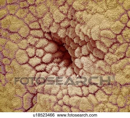 Stock Photograph - Uterus lining, SEM. Fotosearch