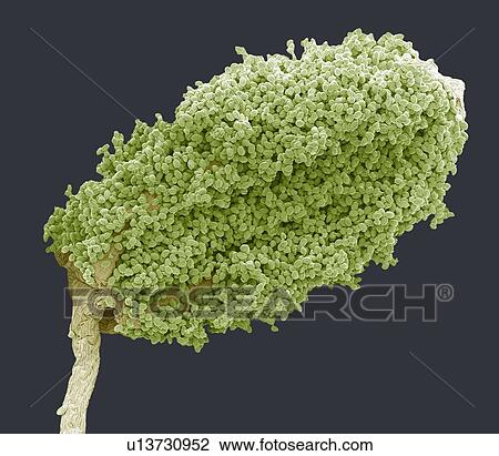 Stock Image - Wood anemone anther, SEM. Fotosearch