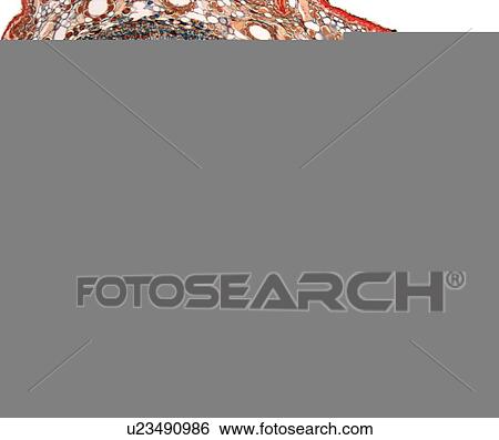 Stock Photograph - Young pine tree stem, light micrograph. Fotosearch