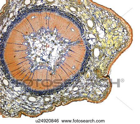 Stock Photograph - Young pine tree stem, light micrograph. Fotosearch